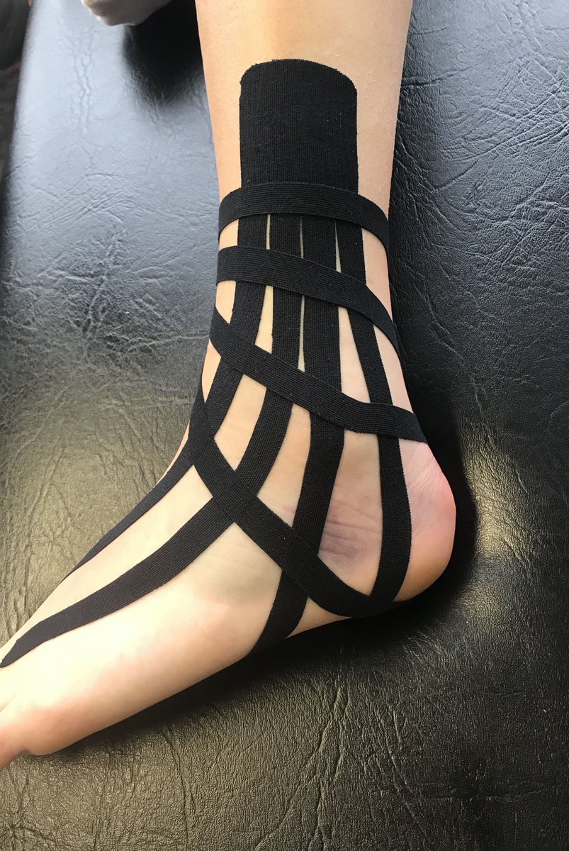 Taping can be used as a great way to reduce swelling and maintain a stable position of bones and muscles during athletic activity #taping #macptgroup #sportstherapy #stability #strength