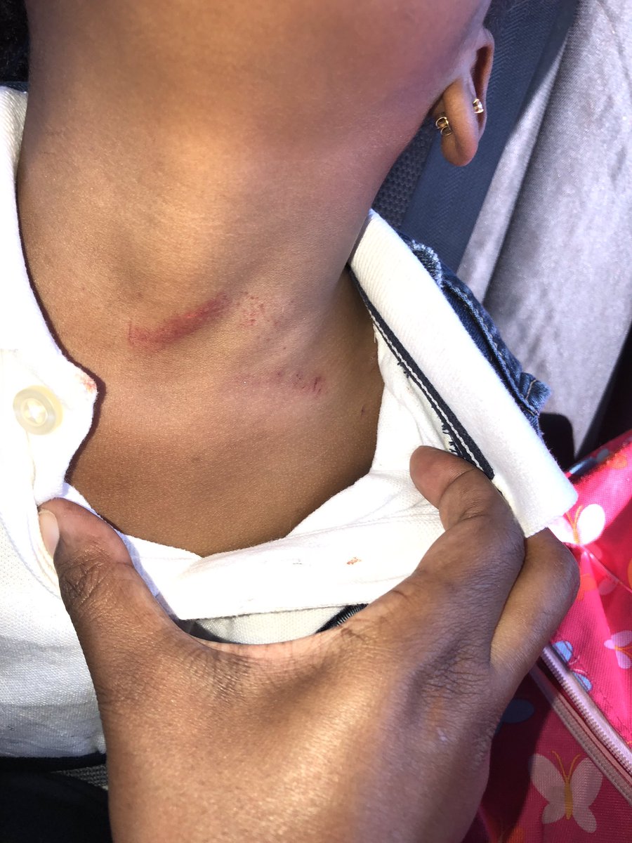 #SecureOurSchools <a href="/ABC/">ABC News</a> <a href="/cnnbrk/">CNN Breaking News</a> <a href="/NBCNews/">NBC News</a> <a href="/FOX4/">FOX 4 NEWS</a> @AtwoodMcDonald THIS WAS NO ACCIDENT!!!! I want answers NOW!!!