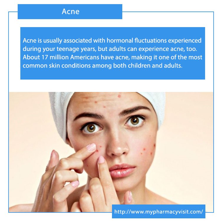MyPharmacyVisit's tweet photo. The most common topical prescription medications for #acne are as follows: #Retinoids and retinoid-like drugs. These come as creams, gels and lotions. #antibiotics These work by killing excess skin bacteria and reducing redness. #Salicylic acid and #azelaic acid.
#pharmacy https://t.co/K0LqEbujYo