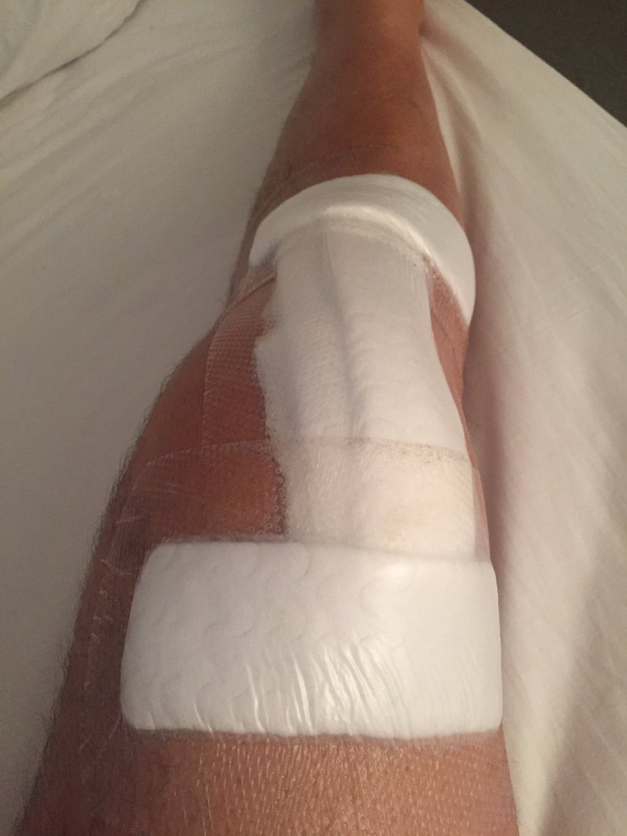 goodwinks's tweet photo. Won’t mean much to many but 4 weeks after the pic, I’ve just got to #103degrees #NoPainNoGain #Tears! #Target110 https://t.co/qcYjWbiAHv
