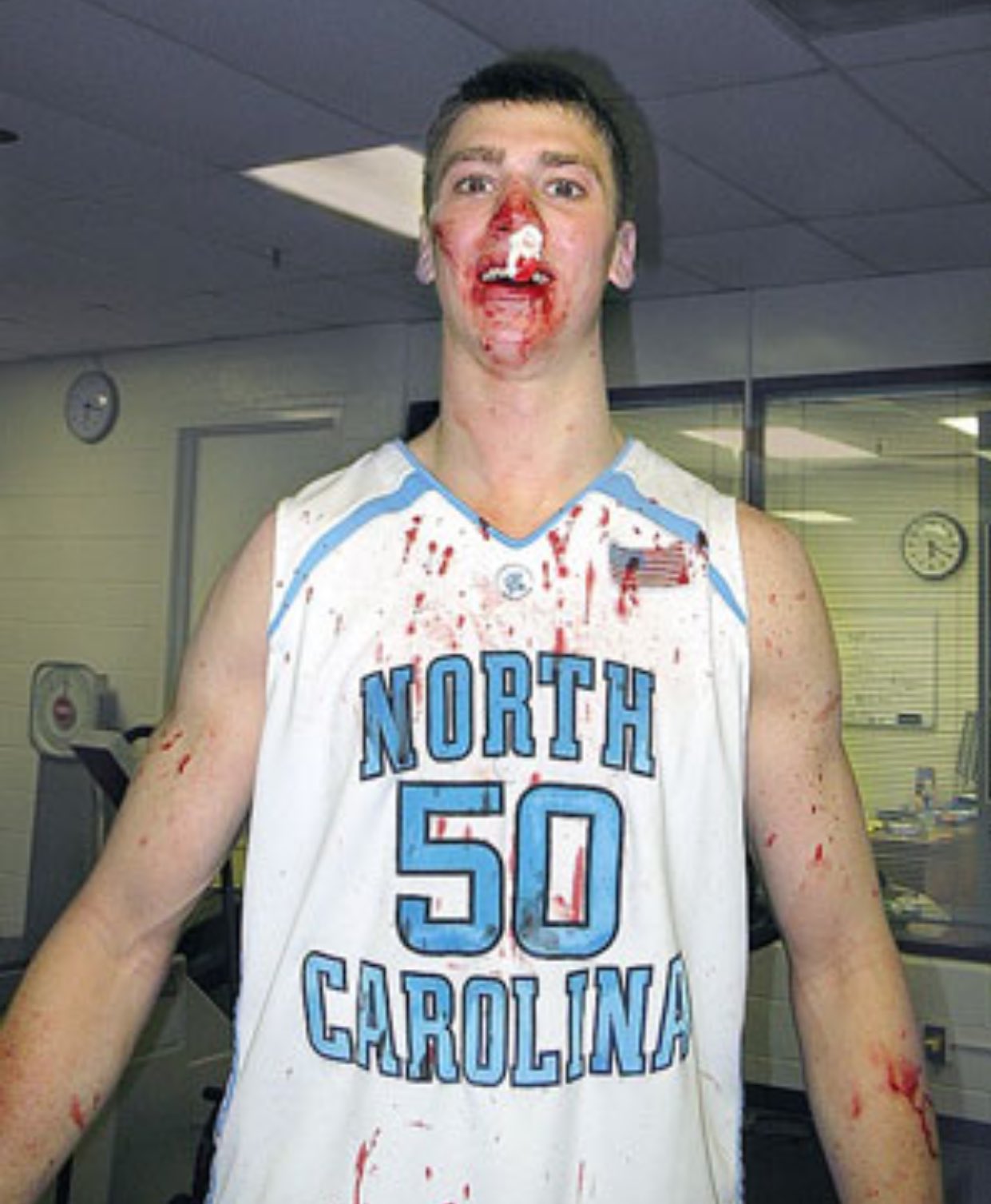 tyler hansbrough bloody nose