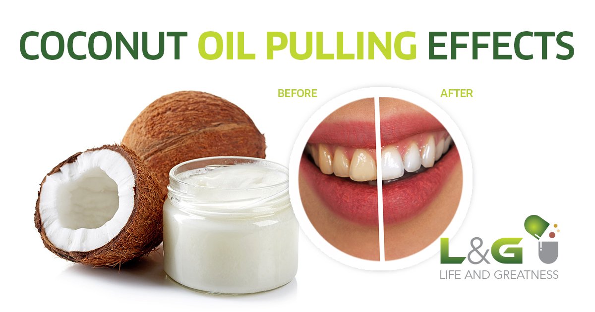 LG365Days's tweet image. Top 7 #Health Benefits of Oil Pulling ==&amp;gt; lifeandgreatness.com/top-7-health-b…