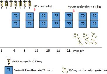 New endometrial priming approach in #eggdonation Nueva preparación del endometrio en #Ovodonación <a href="/iviclinics/">IVIclinics</a> #rbmo authors.elsevier.com/a/1X-3i5Ersdv3…