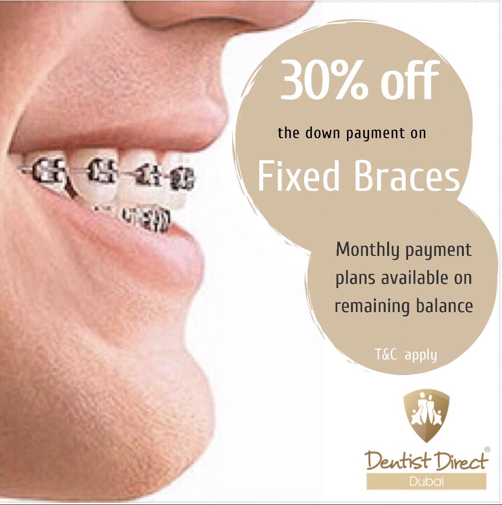 DentistDirect's tweet photo. Take 30% off the down payment on your Fixed Brace Treatment. Monthly Payment plans available on remaining balance. 
(Terms &amp; Conditions apply. Age 8 + 
Price does not include retainers needed for after treatment)
To book your appointment contact us now:
Tel: 044559398 https://t.co/gyMZp7RsKC