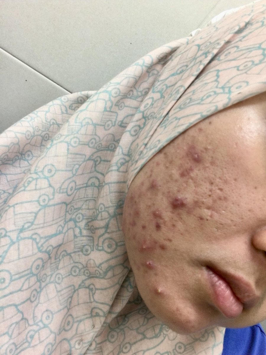 cosmoderm night cream