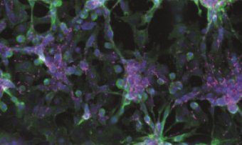 MiMicLab (@rasponimarco) on Twitter photo Check out our chapter in #MethodsCellBiol about generating #cardiac microtissues in beating #HeartOnChip: bit.ly/2zrRWQh
#microfluidics <a href="/polimi/">Politecnico di Milano</a> #OrganOnChip StefanoUgolini @Roberta06427700 <a href="/DCruzMoreira/">Daniela Cruz-Moreira</a> AndreaMainardi MarcoRasponi Check out our chapter in #MethodsCellBiol about generating #cardiac microtissues in beating #HeartOnChip: bit.ly/2zrRWQh
#microfluidics <a href="/polimi/">Politecnico di Milano</a> #OrganOnChip StefanoUgolini @Roberta06427700 <a href="/DCruzMoreira/">Daniela Cruz-Moreira</a> AndreaMainardi MarcoRasponi