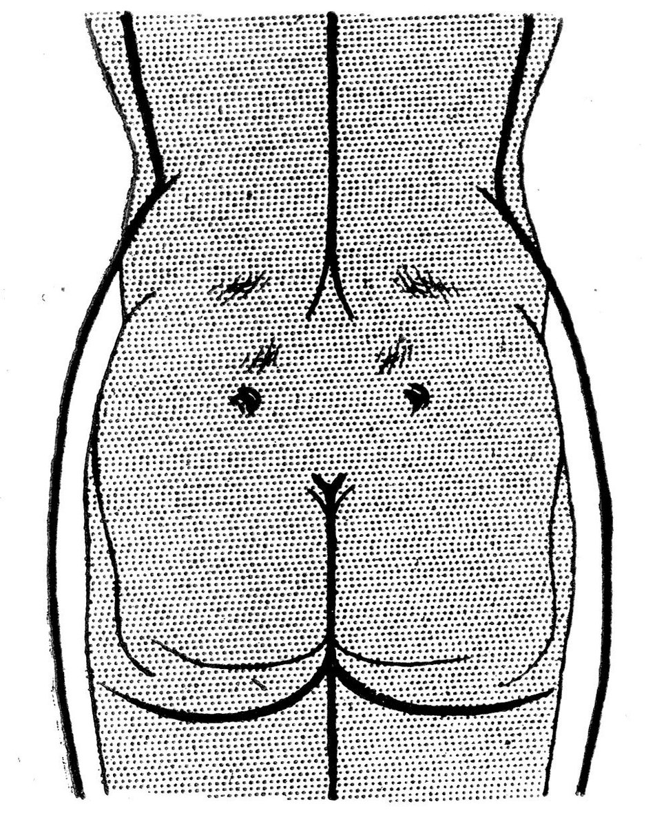 フィットネスなどの解説で女性の解剖図を見かけるが、しばしば不自然に感じるのは殿部である。脂肪の厚みが考慮されていないと、腰回りの筋が異様に発達して見える。 