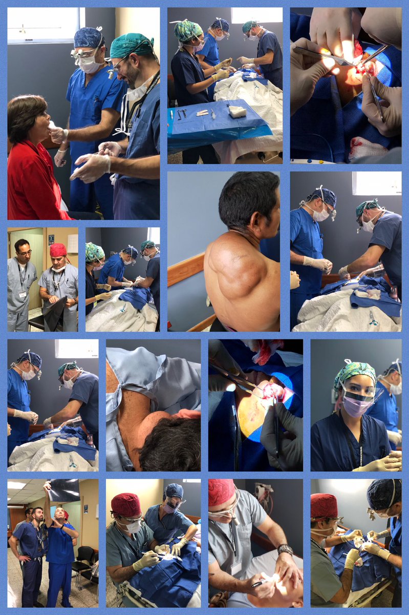 OITeamENT's tweet photo. Clinic evaluations showed a robust presence of plastic surgery malformations and complex tumors..the schedule is set for the week and we spent most if Sunday operating on smaller facial deformities and neck masses, with some very large tumors to come https://t.co/S21axiYaKz