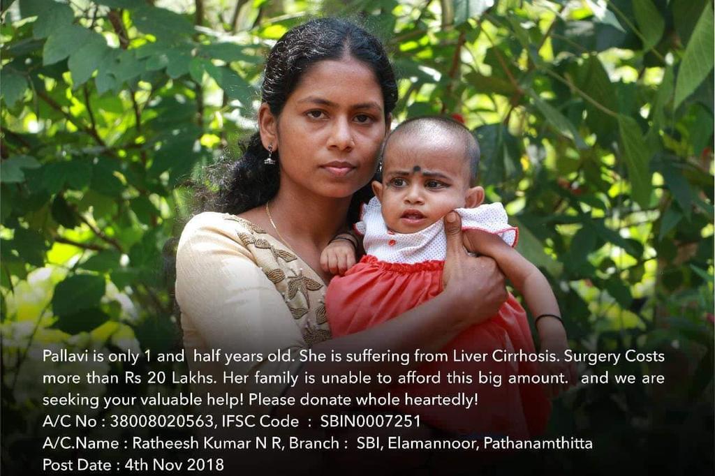 nishthvanth's tweet image. ഒന്നരവയസുള്ള പല്ലവിമോൾക് ലിവർസിറോസിസ് ആണ്.വയറിൽ ഫ്ലൂയിഡ് നിറഞ്ഞിരിക്കുന്നു.സർജറിക്ക് 20 ലക്ഷം വേണം.നിർദ്ധനരായ മാതാപിതാക്കൾക്ക് താങ്ങാവുന്നതിലും അപ്പുറമാണ്.ദയവായി സഹായിക്കുക

Account Name :Ratheesh N R
Account Number : 38008020563
IFSC : SBIN0007251
Branch : Elamannoor Branch, SBI