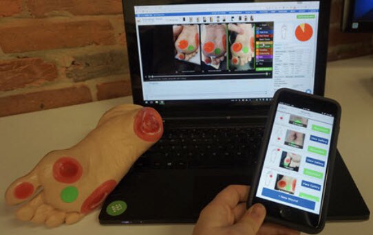 Eos Analytics (@eosanalytics) on Twitter photo Wound treatment centers in the US have partnered with <a href="/TissueAnalytics/">Tissue Analytics</a> . A startup using #AI and smartphone 3D imaging to measure wounds and develop improved treatment protocols #bedsores #surgery #HealthTech prnewswire.com/news-releases/… Wound treatment centers in the US have partnered with <a href="/TissueAnalytics/">Tissue Analytics</a> . A startup using #AI and smartphone 3D imaging to measure wounds and develop improved treatment protocols #bedsores #surgery #HealthTech prnewswire.com/news-releases/…