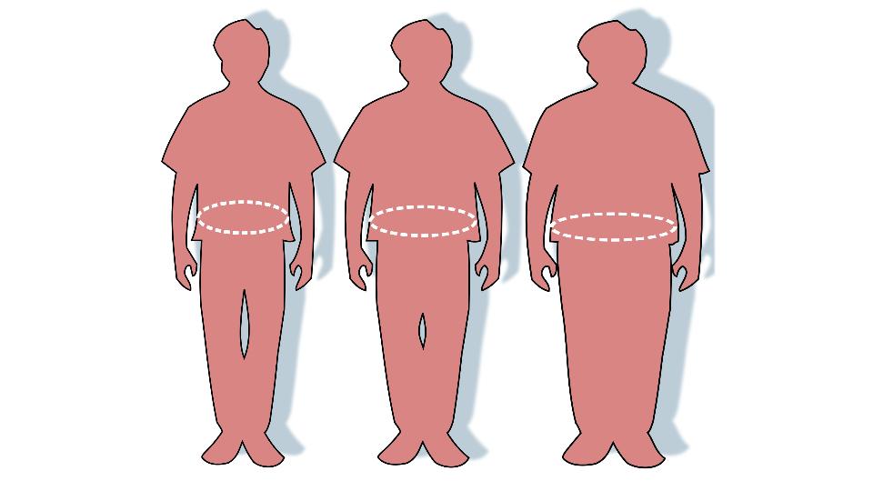 Is it time to question obesity-based cutoffs in kidney transplantation? Recent study suggests outcomes for obese patients are not inferior to those of patients with BMI 35 and under bit.ly/2OlAClm