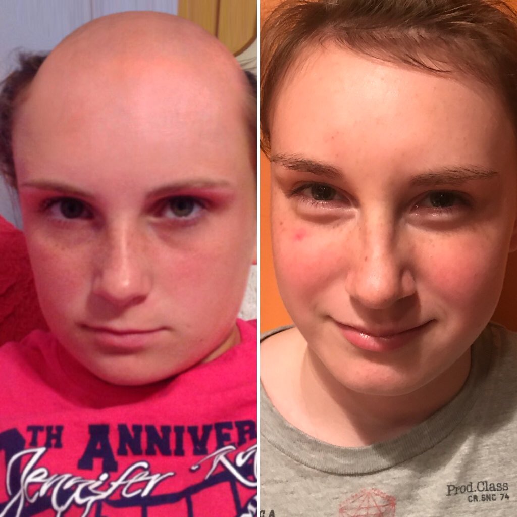My niece on the right today at 13 years old. On the left is Kayla Connors sister 2 years ago at 14 years old. #doppelganger