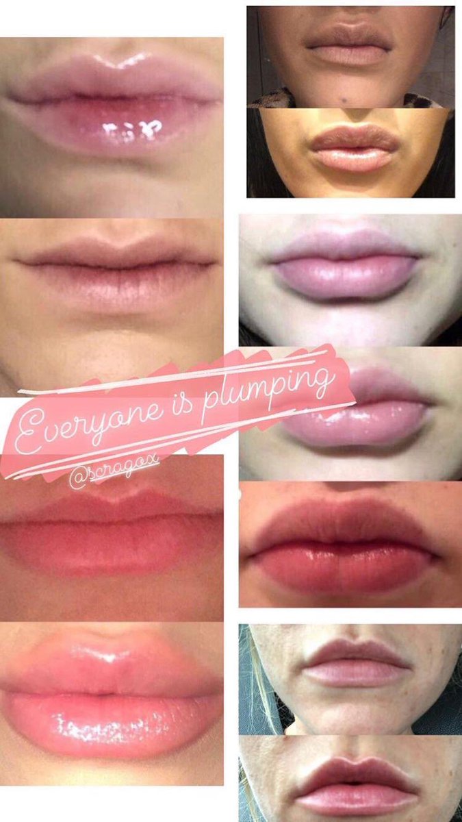 embraceurimage's tweet photo. Fillers are the trend right now but I personally can’t wait to get my hands this plumping lip balm 👄 They’re lips look 3x the size 😍 #lipfillers #lipplumper #lipplumpingbalm #naturallipplumper #naturallipplump https://t.co/hHYC9Lf6R9