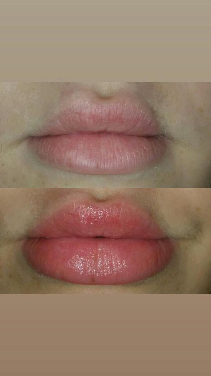 embraceurimage's tweet photo. Fillers are the trend right now but I personally can’t wait to get my hands this plumping lip balm 👄 They’re lips look 3x the size 😍 #lipfillers #lipplumper #lipplumpingbalm #naturallipplumper #naturallipplump https://t.co/hHYC9Lf6R9