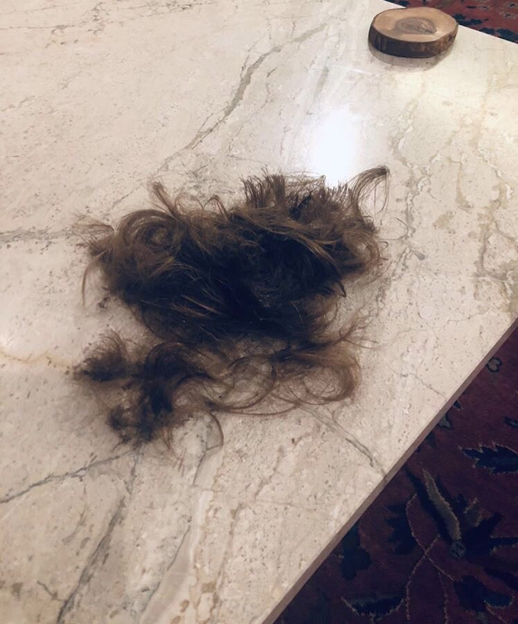 DailyTaronNews's tweet photo. It happened! Taron is officially bald! The dedication he had to Rocketman resulted in a hairless Taron! https://t.co/nhadb3hdM1