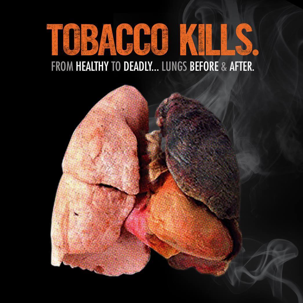 SDQuitLine's tweet image. From healthy to deadly... Tobacco use accounts for at least 30% of all cancer deaths, causing 87% of lung cancer deaths in men, and 70% of lung cancer deaths in women. Quit today. Visit SDQuitLine.com/enroll  or call 1-866-SD-QUITS #LungCancerAwarenessMonth #SDQuitLine