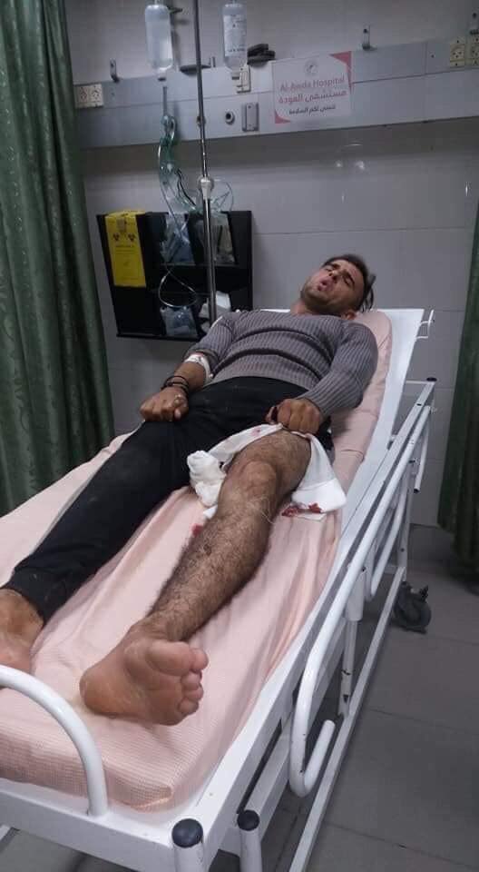 yabastaedibese's tweet photo. "Vi Ricordate di lui? Ieri gli hanno sparato"
Gli hanno sparato perchè non ha smesso di lottare e manifestare.
Gli hanno sparato perché la sua foto era abbastanza forte da riportare in auge la causa della #Palestina ai media. 

via @rubio_chef 

#FreePalestine https://t.co/A0pxN9LSgT