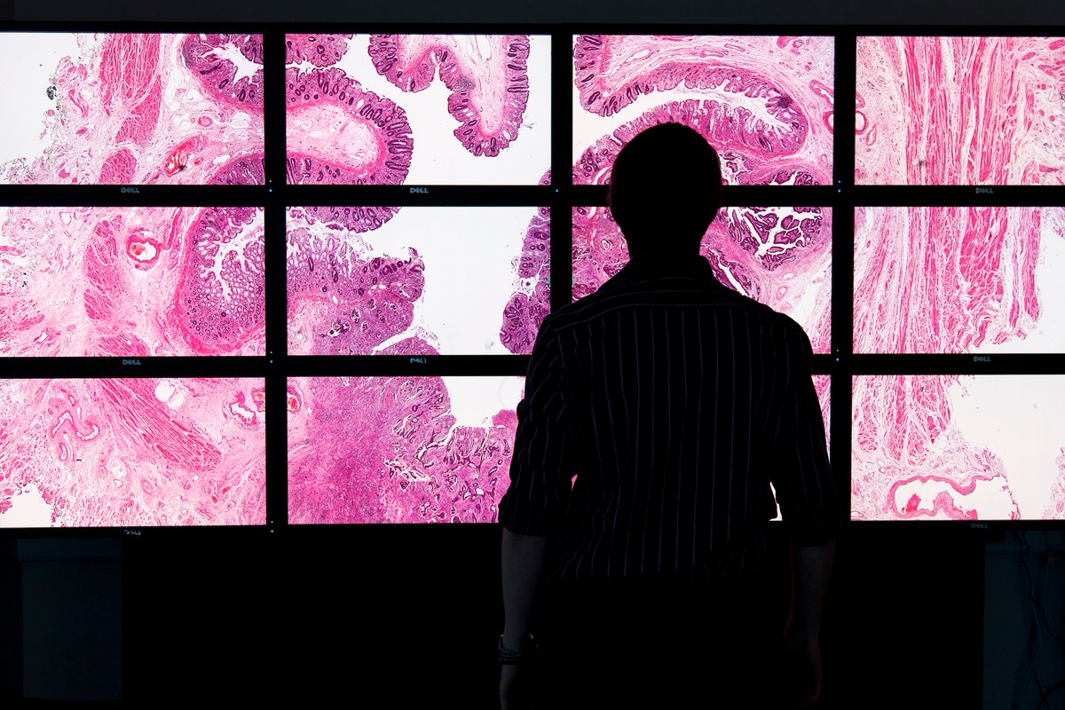 UniversityLeeds's tweet photo. Together with @LeedsHospitals, the University will lead a new £10m @beisgovuk investment to establish a world-leading centre for applying artificial intelligence to cancer diagnosis:   https://t.co/z0PYFJprjt https://t.co/Se7EfGSTm6