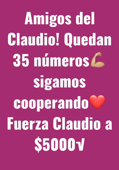 joceaceituno's tweet image. #FuerzaClaudio @DANIEL_VISION @KarendTV @PANCHOSAAVEDRA Para cubrir gastos hospitalarios! Datos  Transferencia: Verónica Cid Lemun Cuenta Rut : 11.994.916-5 Banco Estado enviar vauche o foto deposito porfa.
