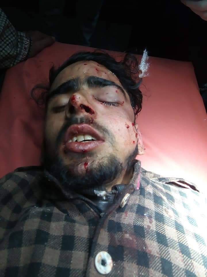 MirwaizKashmir's tweet photo. Govt forces went berserk in Qaimoh village of Kulgam,south Kashmir,fire pellets indiscriminately at protestors injuring many, hitting eyes and other vital organs ! https://t.co/mDUX0y1DJC