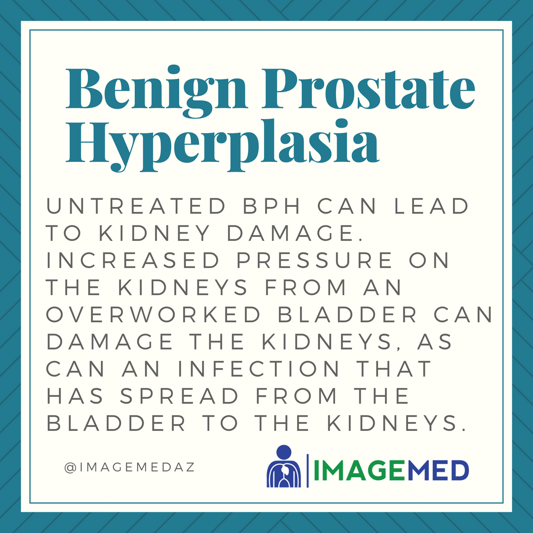 imagemedaz's tweet photo. Here is a BPH fact! Prostate artery embolization is a treatment that is minimally invasive that is used to treat BPH! Visit our website by clicking the link in our bio and learn more about prostate artery embolization!
.
.
#bph #prostate #enlargedprostate #embolization #treatment https://t.co/AbLZ61AvG8