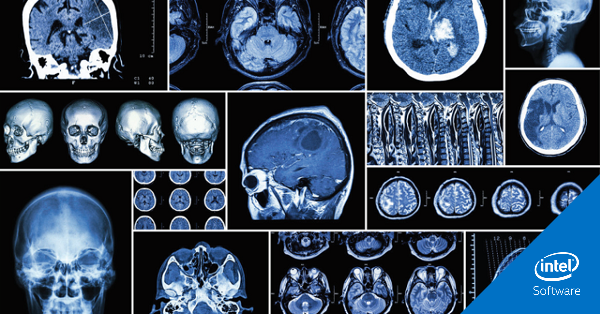 Read this Intel AI Academy success story about how the power of #AI delivers medical screening services to rural populations. intel.ly/2F6AdUy #IntelAI