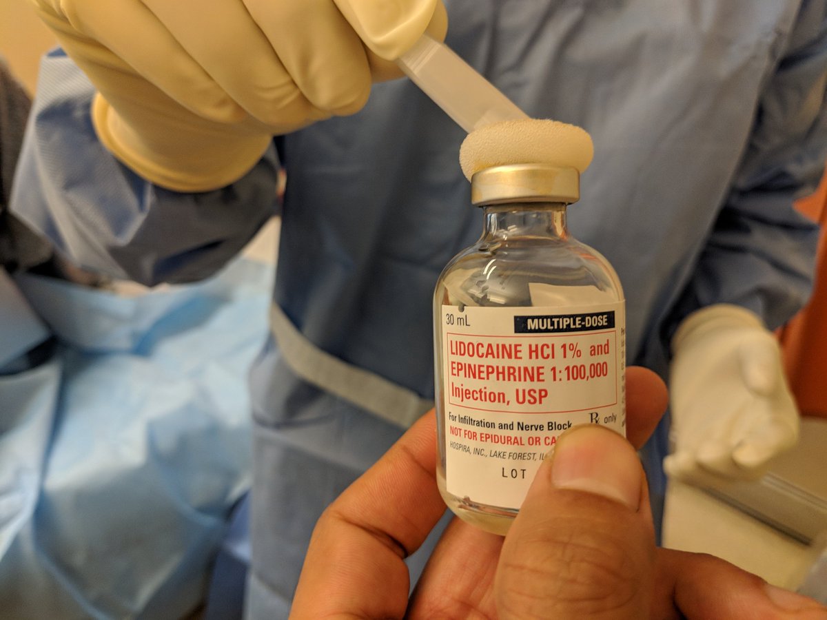 Ideally you have now created a wheal, anesthetized the periosteum liberally, created and anesthetized a track over the rib, ultimately applying lidocaine all the way up to the pleura. Doing this well is critical! We use 1% lido with or without epi.