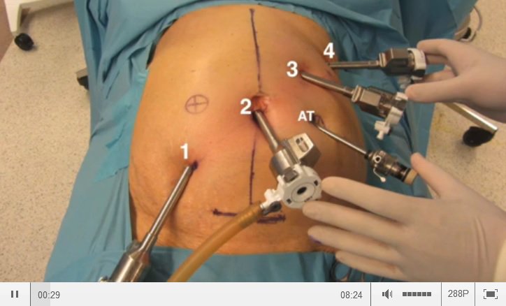 Techniques in Coloproctology Journal tweet media
