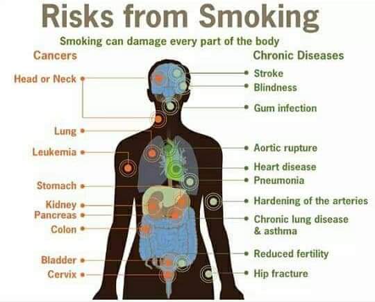 BunnyLawrence7's tweet photo. SMOKING CIGARETTES! !!

Do you smoke? You have certainly have friends and family nagging you to stop smoking! even as you reach for a cigarette, you know very well that's it's dangerous for your health right? Its the leading cause of lung cancer, COPD! etc https://t.co/fb3tH3U4xh