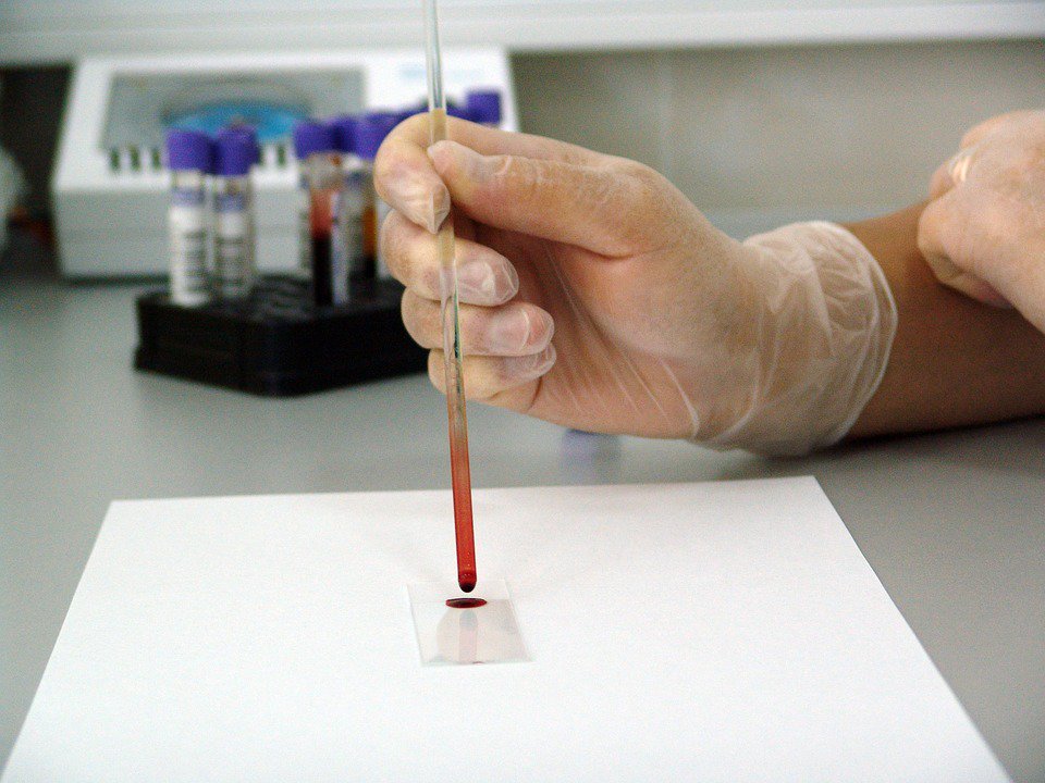 AuScienceMag's tweet photo. Just published our new blog post 'Acute Leukaemia: Promising New Results' at https://t.co/S3ldHfnaQp
#AuScienceMag #medicine #blogging #science https://t.co/JlI4PJB1b6