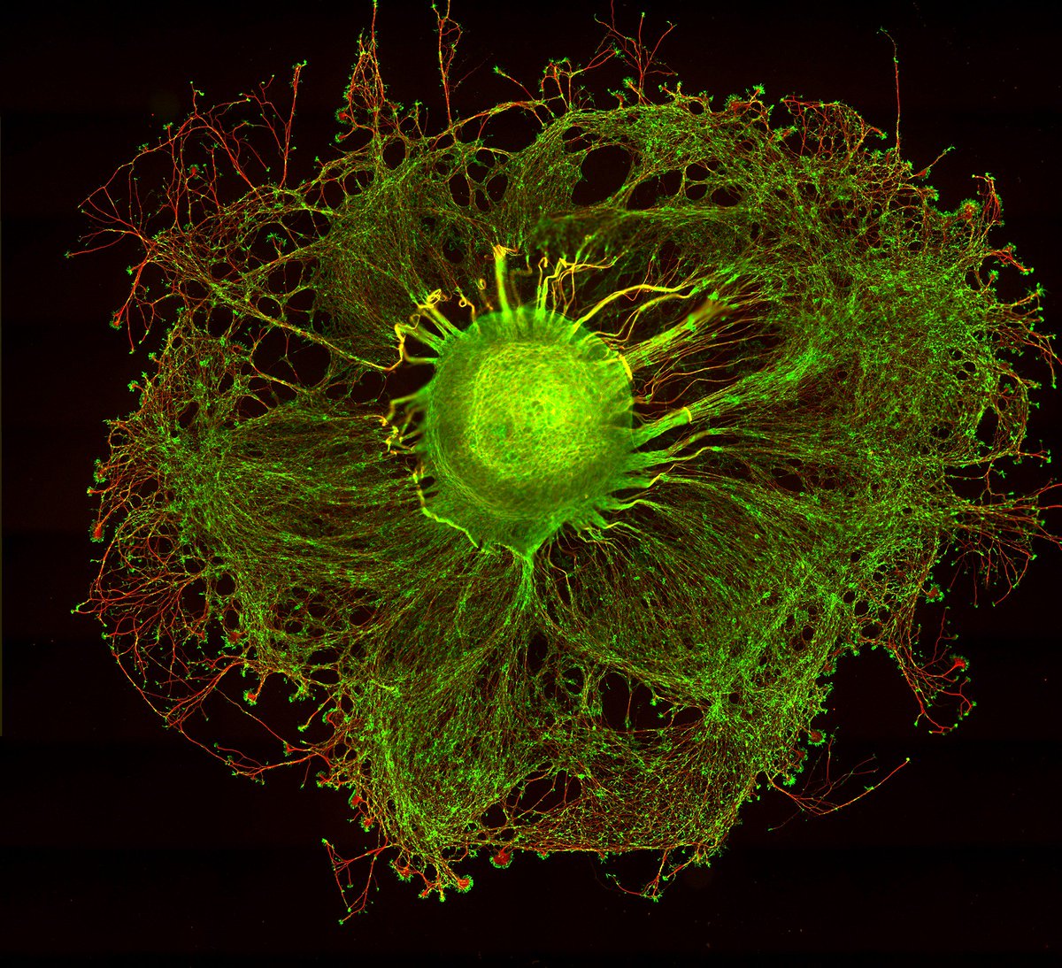 Géraldine Fabre (@gefabre) on Twitter photo (H)auteurs // Je ne me lasse pas de ce #cellfie d'Eric Denarier et Sylvie Gory-Fauré <a href="/GINeuroGrenoble/">GIN Neuro Grenoble</a>. C'est une des belles photos de #microscopie de #fluorescence publiées dans le dernier portfolio du mag' : La vie en fluo ! À retrouver là : bit.ly/PortfolioGIN (H)auteurs // Je ne me lasse pas de ce #cellfie d'Eric Denarier et Sylvie Gory-Fauré <a href="/GINeuroGrenoble/">GIN Neuro Grenoble</a>. C'est une des belles photos de #microscopie de #fluorescence publiées dans le dernier portfolio du mag' : La vie en fluo ! À retrouver là : bit.ly/PortfolioGIN