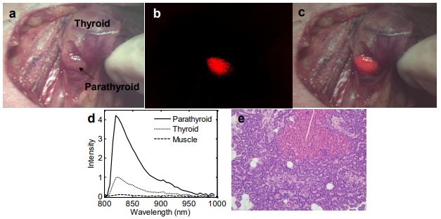 VU_Biophotonics's tweet photo. The parathyroid has a high level of fluorescence at NIR wavelengths that aren't visible to the human eye. Researchers from the #MJLab have developed a number of NIR fluroescence technologies to provide surgeons the ability to clearly identify the parathyroid in the OR. https://t.co/DXBhBXQcmL