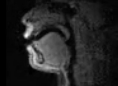 Watching people beatbox in an MRI is mesmerizing: pops.ci/beatboxmri