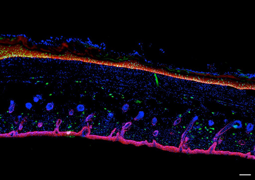 laxmionline's tweet photo. A fully human system to cultivate #skincells for #grafting #laminins #burns #keratinocytes #CellCulture #skin @dukenus https://t.co/6BXWGK0b8o https://t.co/98pqCL3s9j