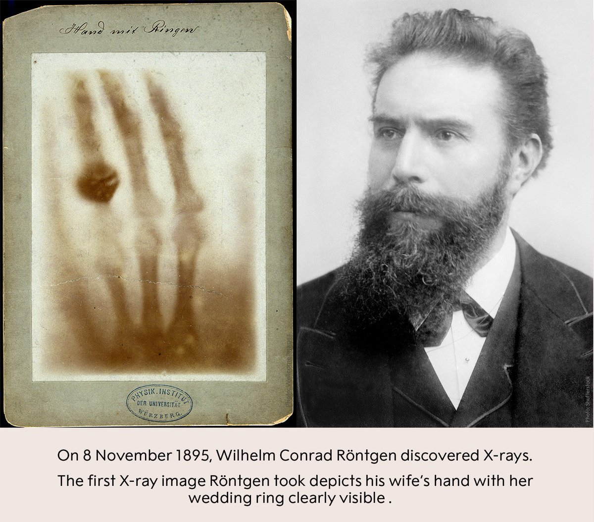 OnThisDay In 1895 Wilhelm Conrad R ntgen Discovered X rays R ntgen onthisday-in-1895-wilhelm-conrad-r-ntgen-discovered-x-rays-r-ntgen