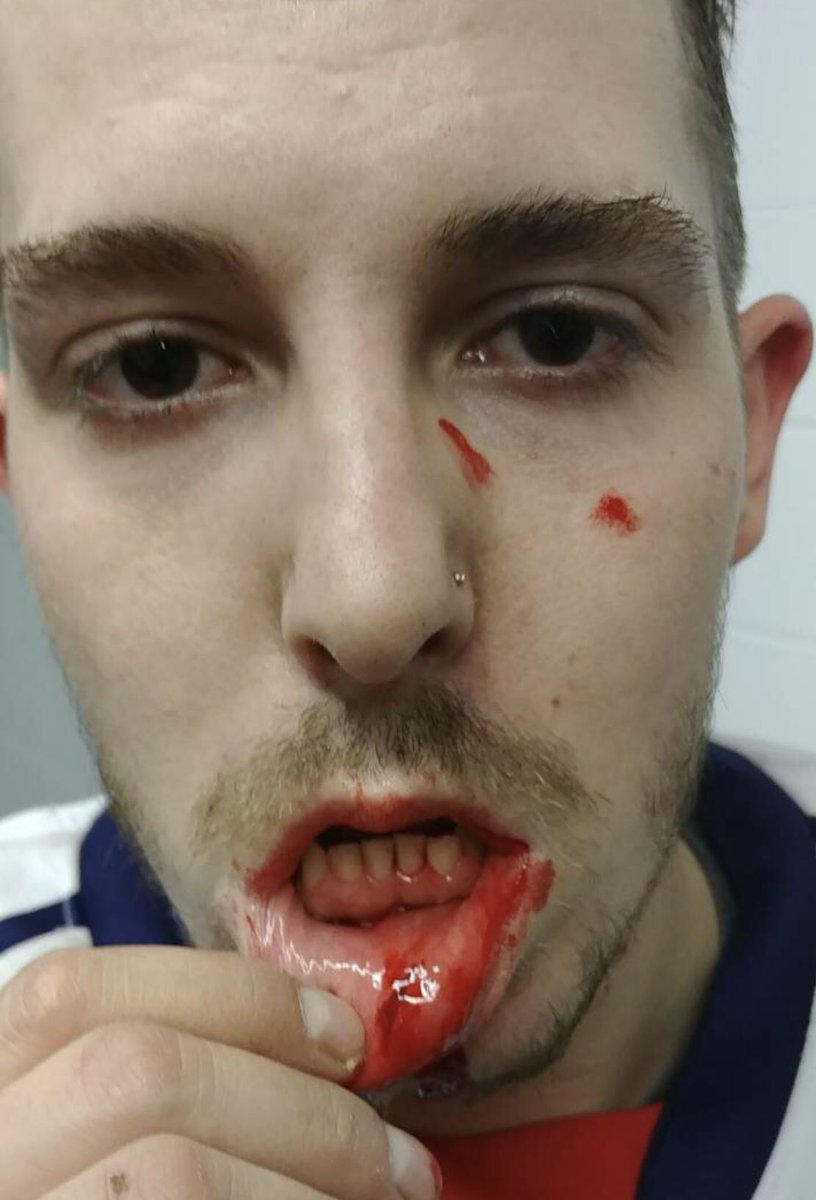 __Carroll's tweet photo. Well fuck.. https://t.co/4O8aLkL5Zr