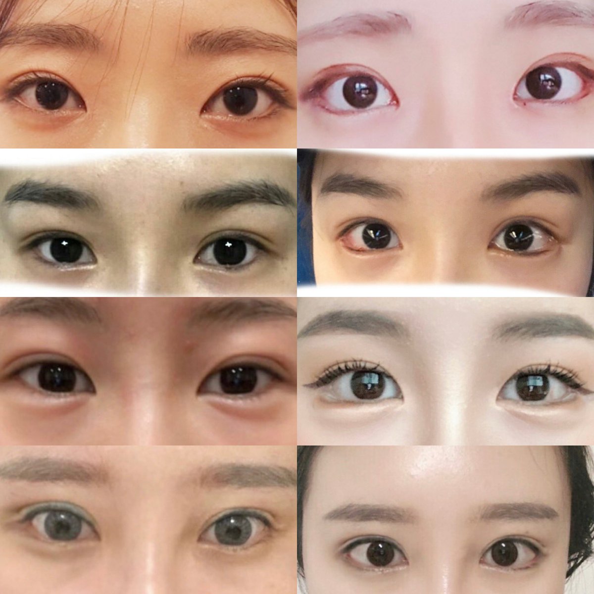 チュパカブラ Meily Ceo この目尻切開 グラマラスの症例が好き過ぎて 同じところでやってきたよー 日本人来ないらしいし 病院内も韓国人でいっぱいだった 私はもうあまり切れないから変化少ないといわれましたが 経過はmeilyに載せてます