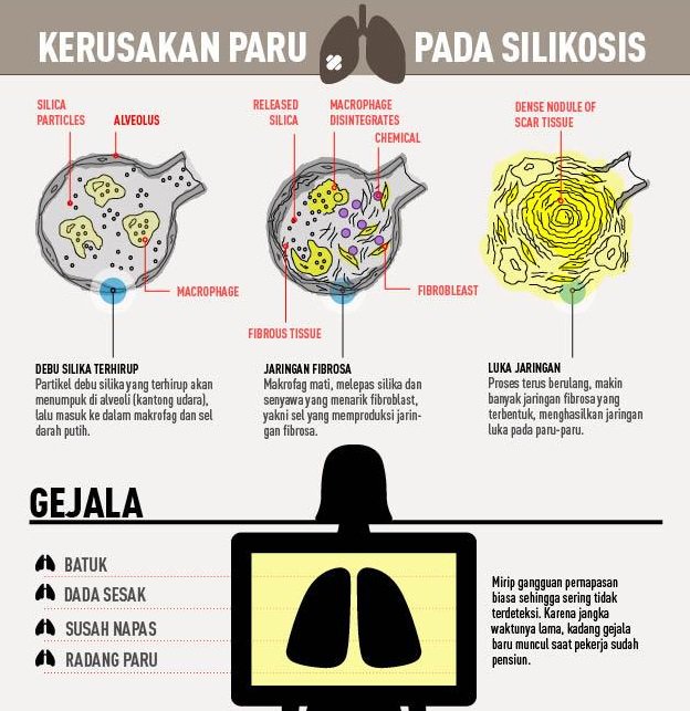 HASEnvironment1's tweet photo. Bahaya Silica Bagi Kesehatan Pekerja.

#hasenvironmental #silica #bahayasilica #monitoringlingkugan #monitoringdebu https://t.co/Bxg5DYxgX5