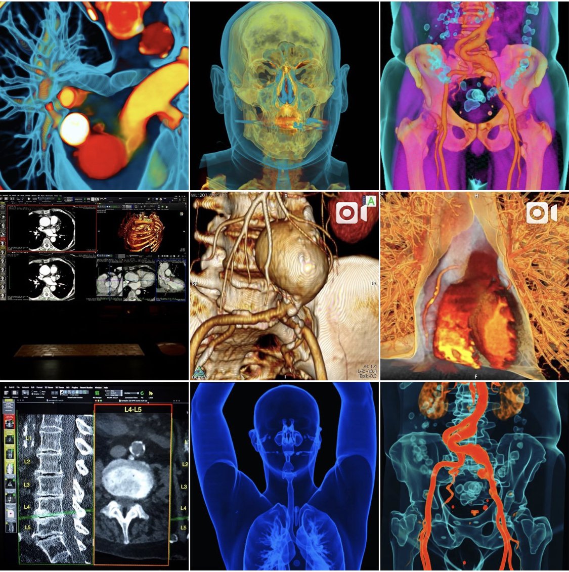 https www instagram com osirixviewer instagram instagram dicom dicomviewer health healthcare mac macos macosmojave medical medicalimaging - medical instagram accounts to follow