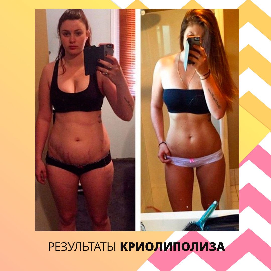 Похудеть В Ижевске.