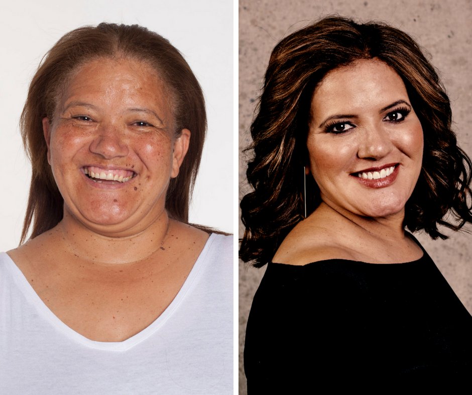 SkinBodyRenewal's tweet photo. Have you seen our #Mooimaak reveals? https://t.co/HC6chKDZb0 Watch the journey over here #Mooimaak2 on @kykNETtv in August 2018 #SkinRenewalSA #Makeover #aesthetics #skin #rejuvenate #restore https://t.co/f1yi4YfYLZ