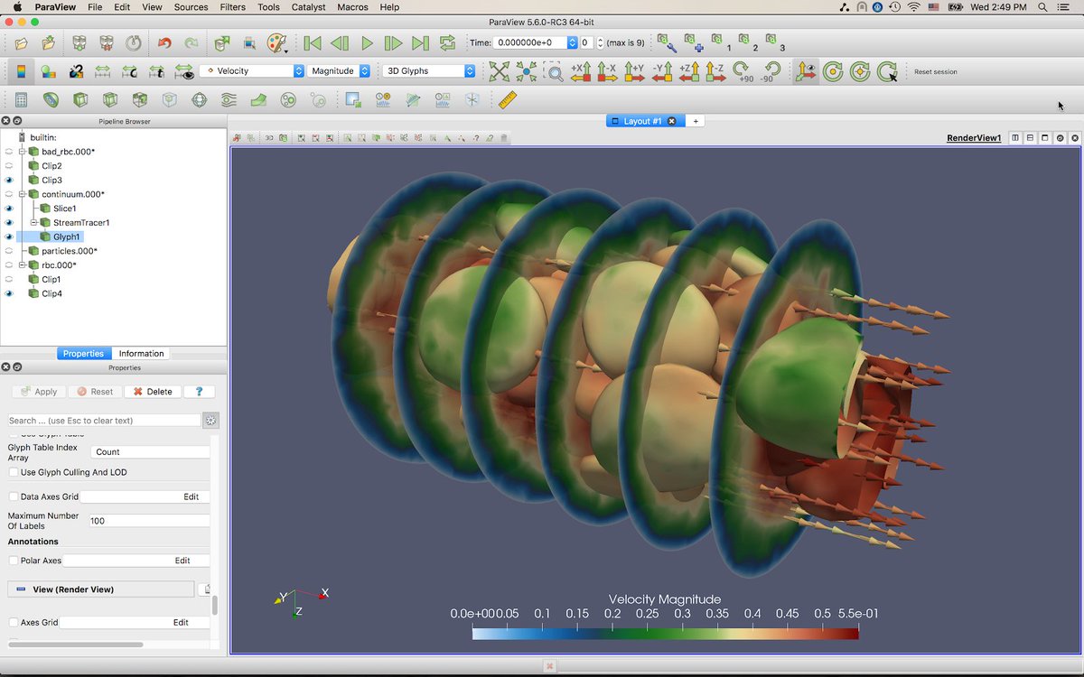 Kitware's tweet image. #ParaView 5.6 is here! This #visualization was #RenderedInParaview using a default color map. The #data is available through the ParaView Red Blood Cell Tutorial from @argonne @ alcf.anl.gov/user-guides/vi…. The data comes from George Karniadakis &amp;amp; Leopold Grinberg @BrownUniversity