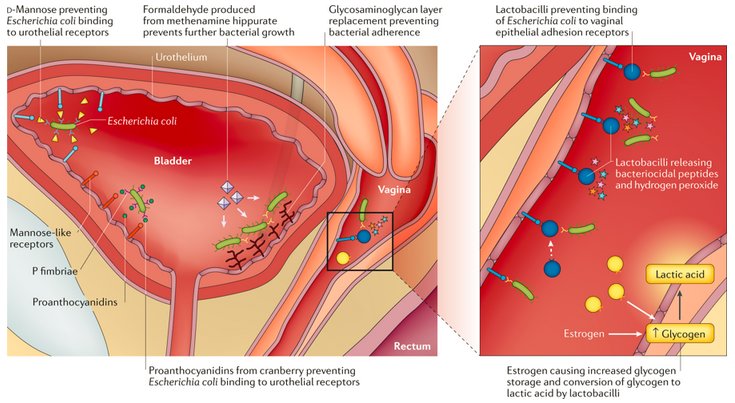 Nature Reviews Urology (@natrevurol) on Twitter photo #NEWinNRU <a href="/nehasihra/">Néha Sihra</a> Anna Goodman <a href="/rhz59/">Rhana H Zakri</a> <a href="/sonnyurol/">Arun Sahai</a> & <a href="/sachmalde/">Sachin Malde</a> discuss nonantibiotic prevention and management of recurrent urinary tract infection #UroUTI go.nature.com/2ASb6kl #NEWinNRU <a href="/nehasihra/">Néha Sihra</a> Anna Goodman <a href="/rhz59/">Rhana H Zakri</a> <a href="/sonnyurol/">Arun Sahai</a> & <a href="/sachmalde/">Sachin Malde</a> discuss nonantibiotic prevention and management of recurrent urinary tract infection #UroUTI go.nature.com/2ASb6kl