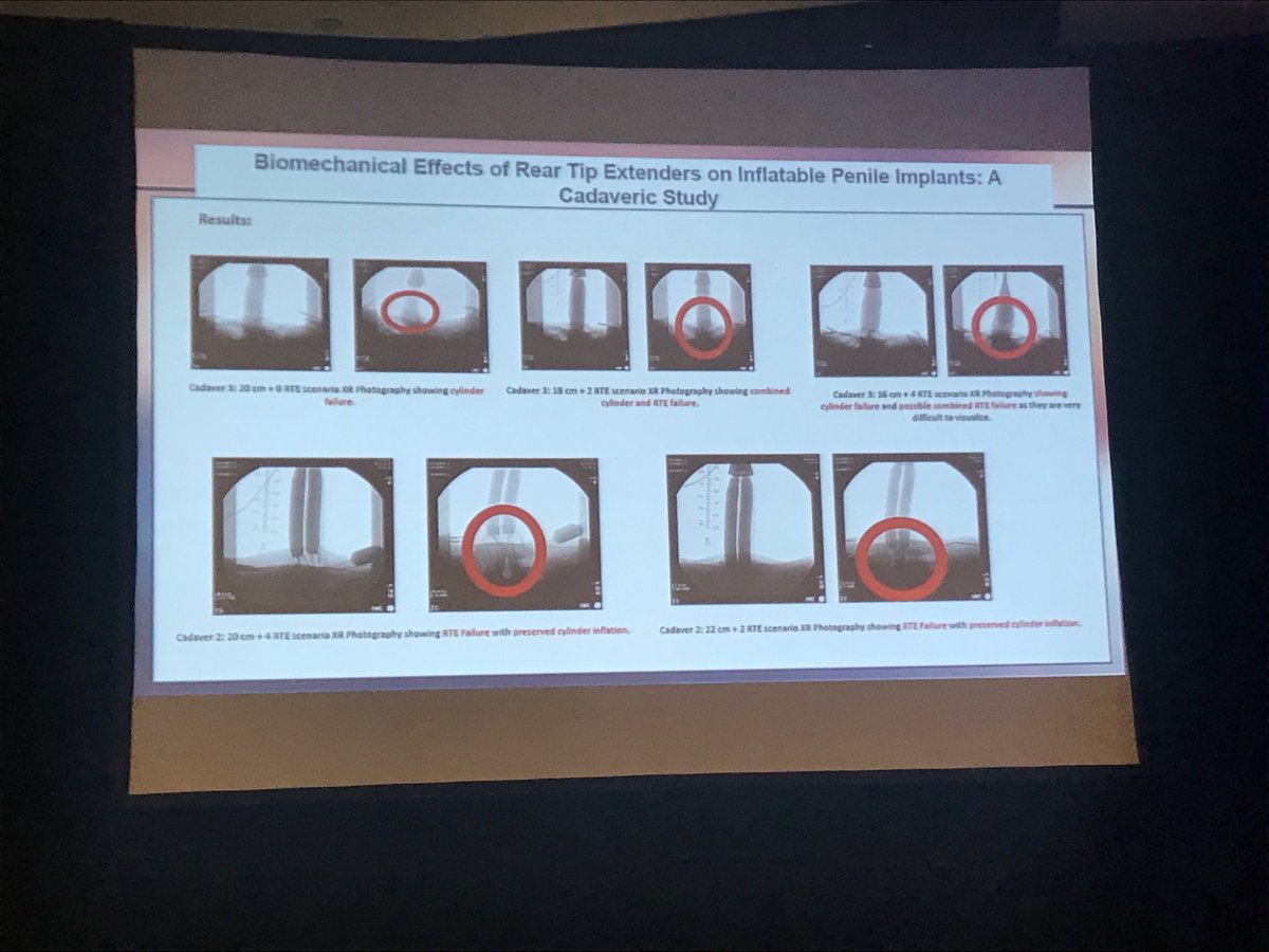 Biomechanical effects of #penileimplant RTEs casaveric study. For larger implants, The more RTE, the weaker the device.  #SMSNA2018