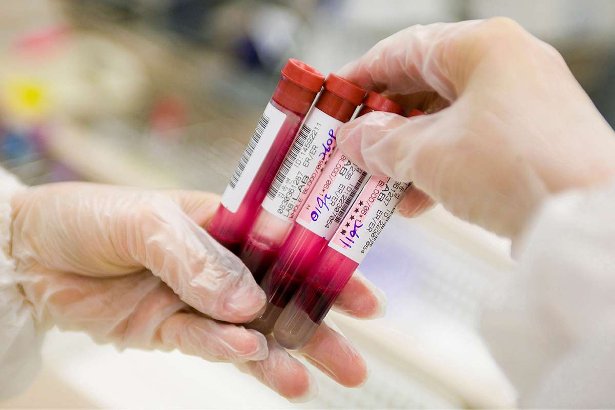 AISlims's tweet photo. Researchers at Cambridge University have devised a new blood test which can spot DNA from eight different types of cancer. How does this differ to the tests currently performed? Have a read of this article from NewScientist.

>>> https://t.co/4FwsbIlanK #DNA #CancerDetection https://t.co/80V3Clruzw