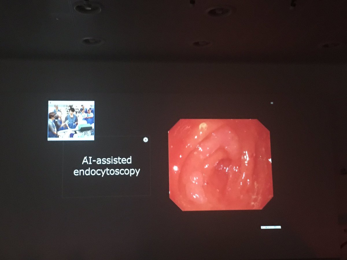 SergioCoda3's tweet photo. Amazing demonstration of #endocytoscopy and #artificial_intelligence #EndoBRAIN by Dr Mori and Professor Kudo @kingslivelondon today.
The era of in vivo endoscopic pathology has started! https://t.co/IkVDEM9FQH