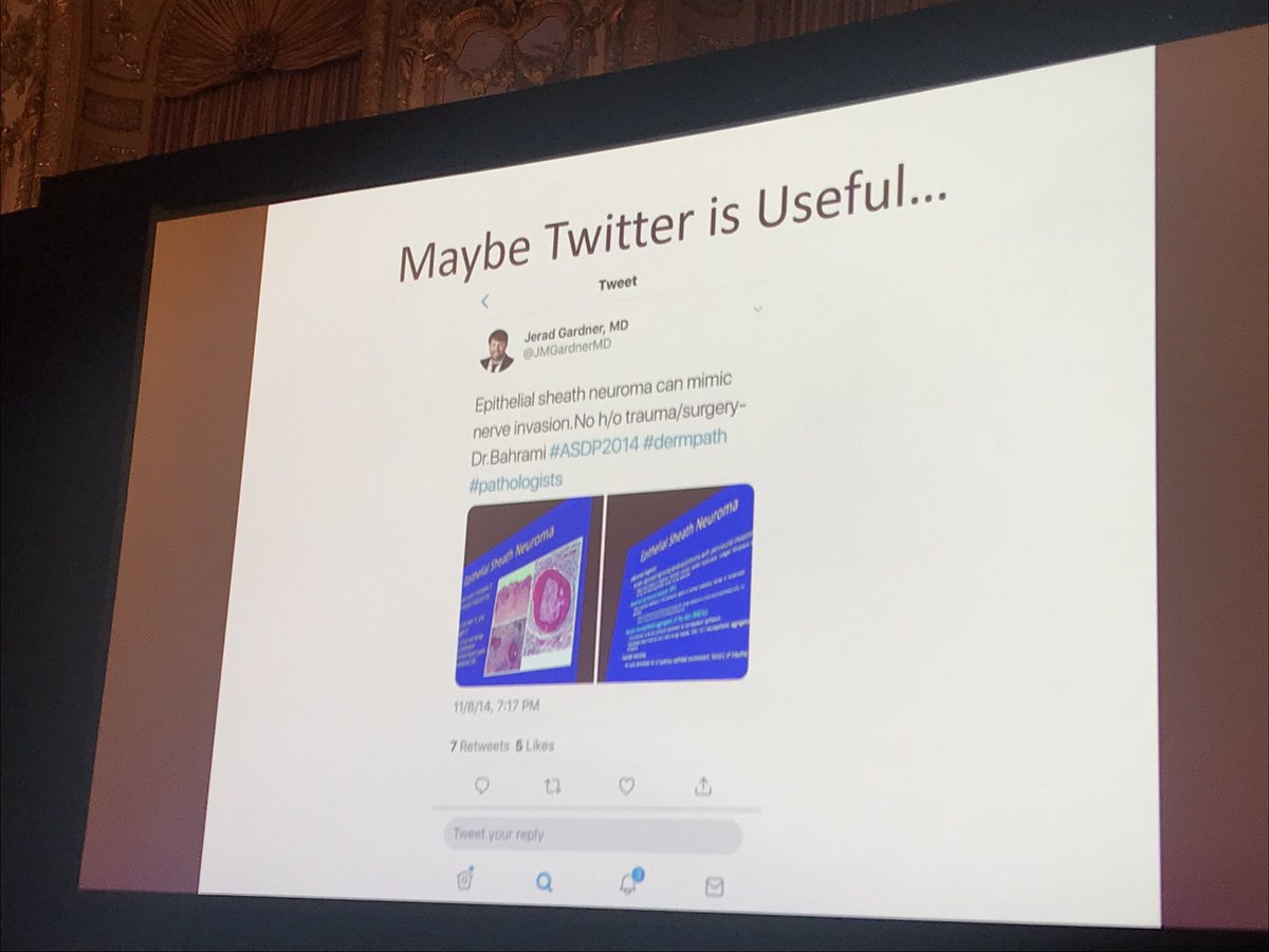 Jerad Gardner, MD (@jmgardnermd) on Twitter photo Beautiful epithelial sheath neuroma! So cool. Almost always on back. 1st learned of this entity in this very hotel at #asdp2014 from <a href="/SoonBahrami/">Soon Bahrami MD</a>....Erick Jacobson-Dunlop kindly cited my old tweet: x.com/jmgardnermd/st… ! #tweetception #meta. #ASDP18 #dermpath #pathology. Beautiful epithelial sheath neuroma! So cool. Almost always on back. 1st learned of this entity in this very hotel at #asdp2014 from <a href="/SoonBahrami/">Soon Bahrami MD</a>....Erick Jacobson-Dunlop kindly cited my old tweet: x.com/jmgardnermd/st… ! #tweetception #meta. #ASDP18 #dermpath #pathology.