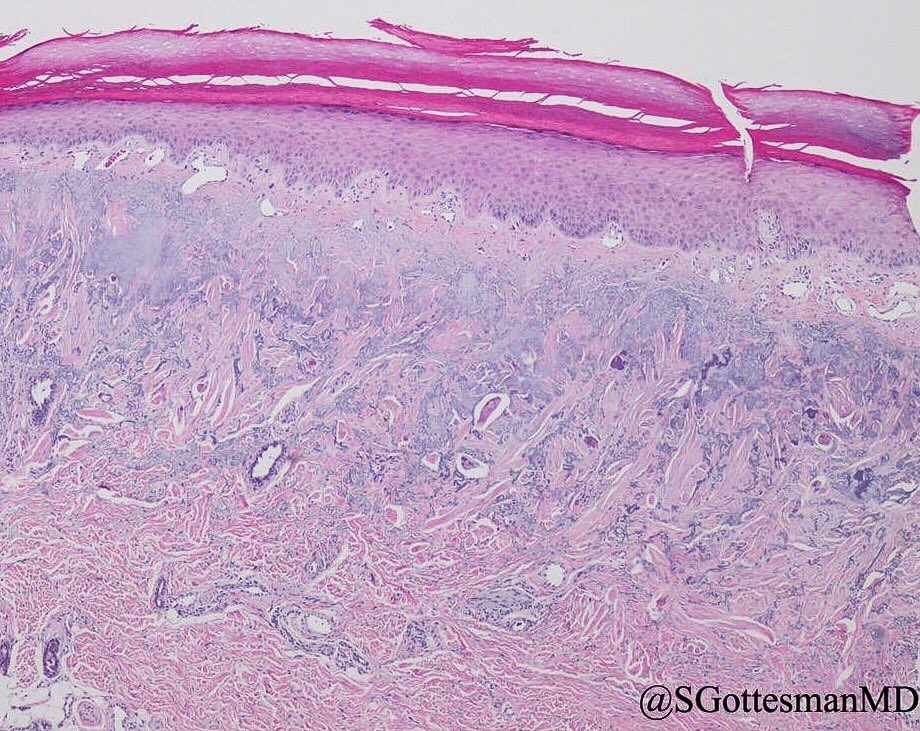 Silvija Gottesman MD tweet media