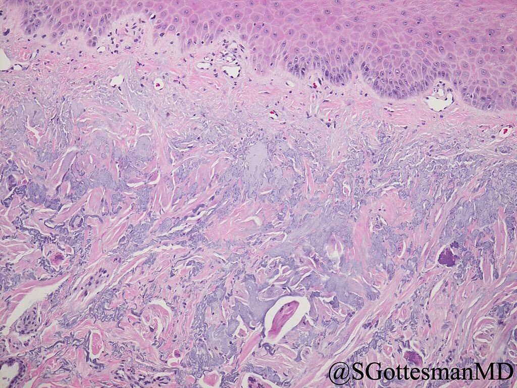 Silvija Gottesman MD tweet media