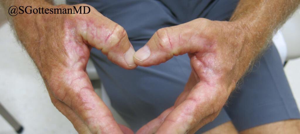 Silvija Gottesman MD tweet media